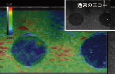 通常のエコーとは違い、硬さをカラーで映し出します