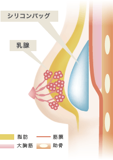 シリコンバッグを入れている為に乳がん検診に抵抗を感じてしまいますが、乳腺用エコーでの診察により、乳腺の状態を診察することができます。