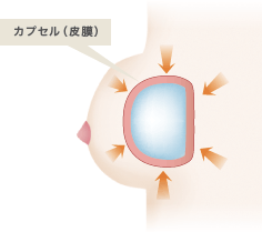 カプセル（皮膜）