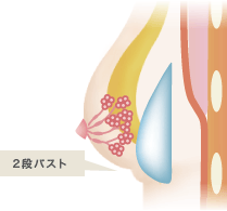 2段バスト