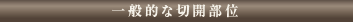 一般的な切開部位