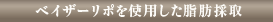 ベイザーリポを使用した脂肪採取