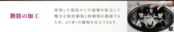脂肪の加工：採取した脂肪から不純物を除去して濃縮した脂肪幹にするため、バストへの脂肪の生着率がUPします