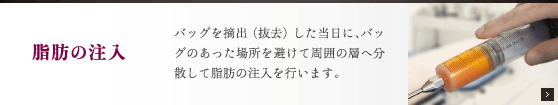 脂肪の注入：バッグを摘出（抜去）した当日に、バッグのあった場所を避けて周囲の層へ分散して脂肪の注入を行います