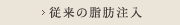 従来の脂肪注入