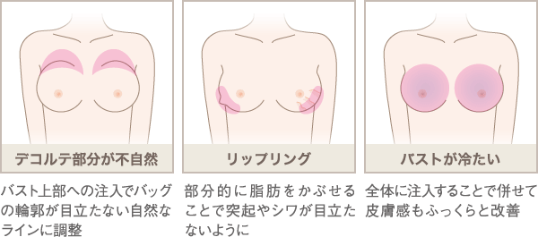デコルテ部分が不自然、リップリング、バストが冷たい
