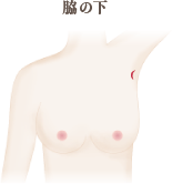 当院(豊胸シリコン外来)の切開部位