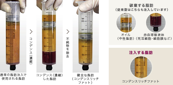 研ぎ澄まされていく脂肪