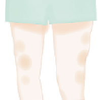 通常の脂肪誘因