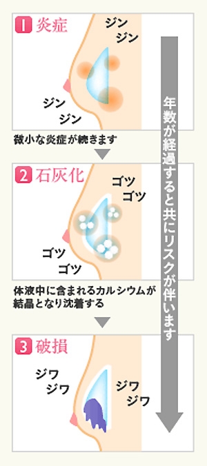 シリコンバッグ トラブル