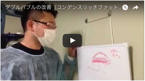 ダブルバブル 修正 動画