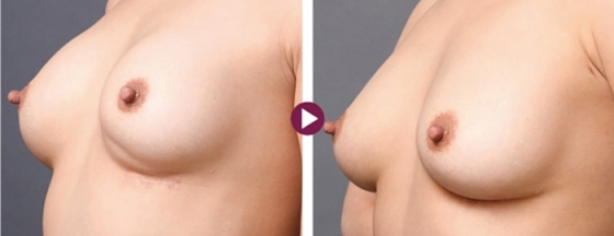 メインイメージ