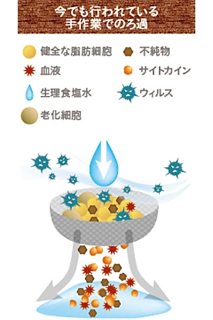 従来の脂肪注入 方法