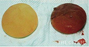 シリコンバッグ 破損 変色