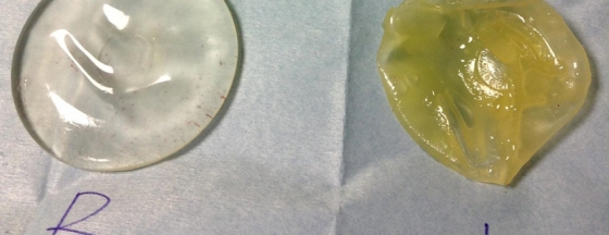 メインイメージ