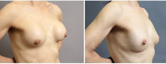 メインイメージ