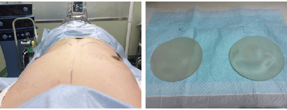 メインイメージ