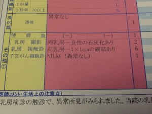 乳がん検診 しこり