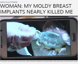 シリコンバッグ カビ 画像