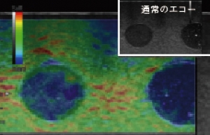 シリコンバッグ エコー検査