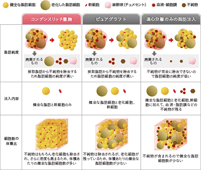 コンデンスリッチ 豊胸