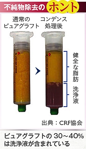 ピュアグラフト コンデンスリッチ