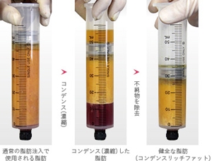 コンデンスリッチファット