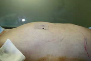 シリコンバッグ