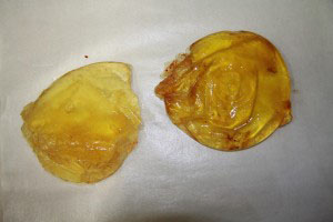 シリコンバッグ豊胸